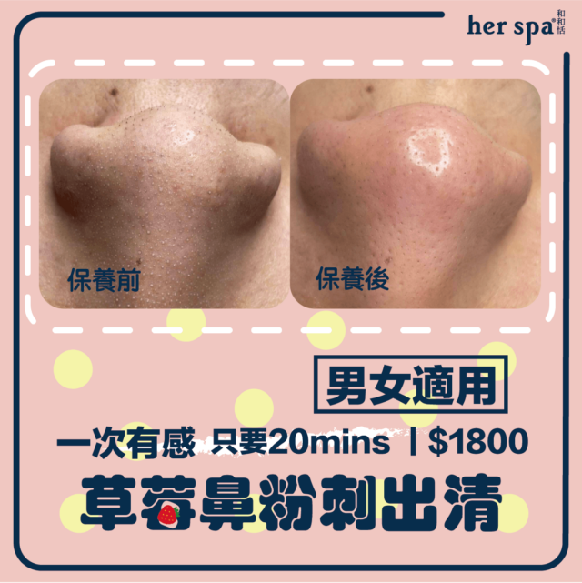 blackheads clean acnes spa wash 台北清粉刺推薦 高雄清粉刺推薦 無痛清粉刺 男士清粉刺