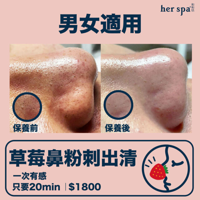 blackheads clean acnes spa wash 台北清粉刺推薦 高雄清粉刺推薦 無痛清粉刺 男士清粉刺