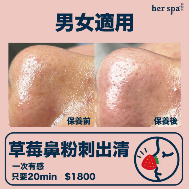 blackheads clean acnes spa wash 台北清粉刺推薦 高雄清粉刺推薦 無痛清粉刺 男士清粉刺