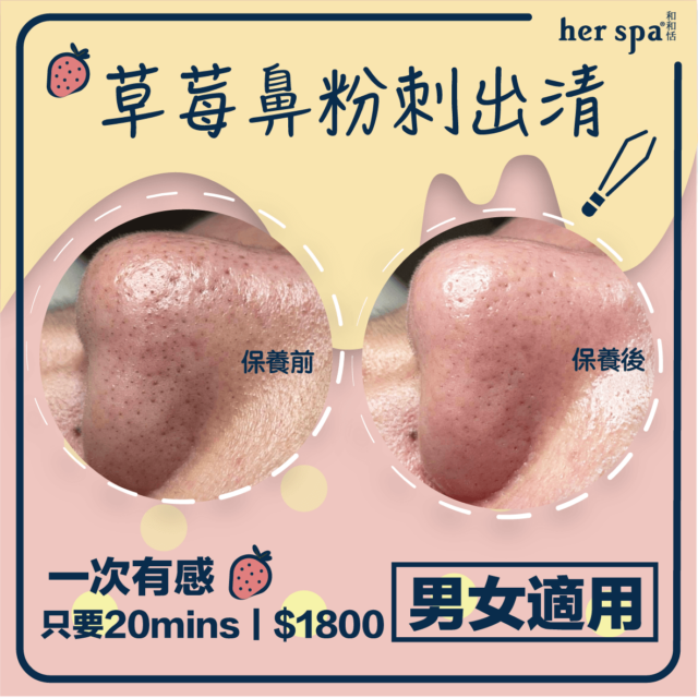 痘疤 黑頭貼 溫和去黑頭 擠痘痘皮膚紅腫 做臉推薦