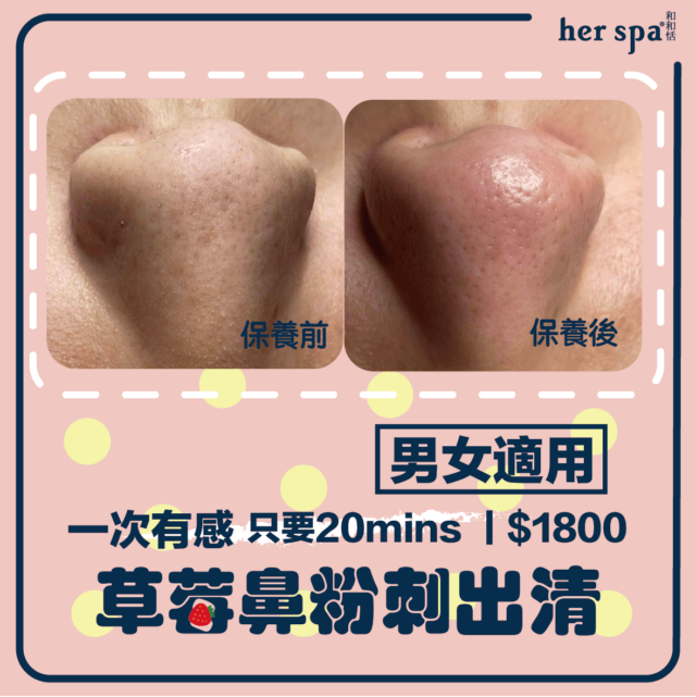 擠痘痘 緊緻毛孔 縮毛孔醫美 痘痘肌保養步驟 痘痘杏仁酸
