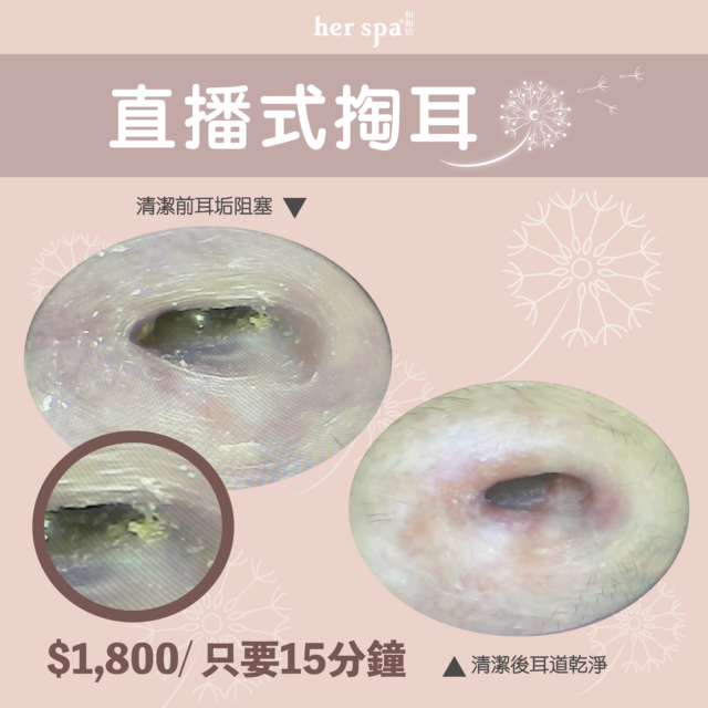 專業掏耳 無痛掏耳 耳穴按摩 頭部放鬆 耳垢