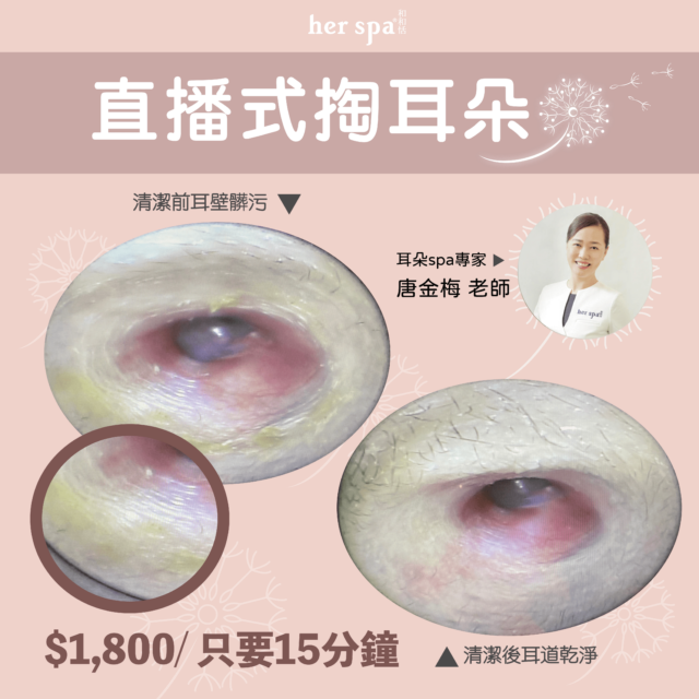 hear pick ear earwax oil 耳垢塞住聽不清楚 耳朵悶塞聽不清楚 聽不見別人說話 耳屎塞住解決