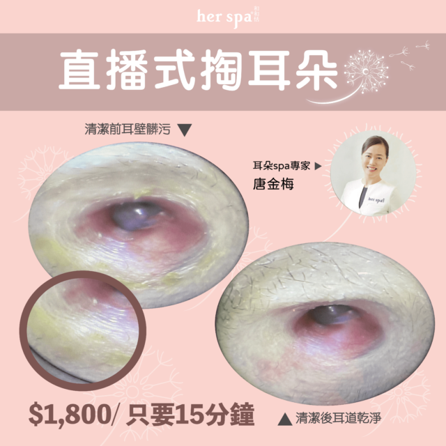 專業掏耳 掏耳推薦 耳朵按摩 高雄掏耳推薦 耳垢