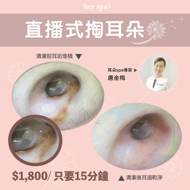 taiwan pick ear earwax clean 掏耳 采耳 直播式采耳 掏耳費用