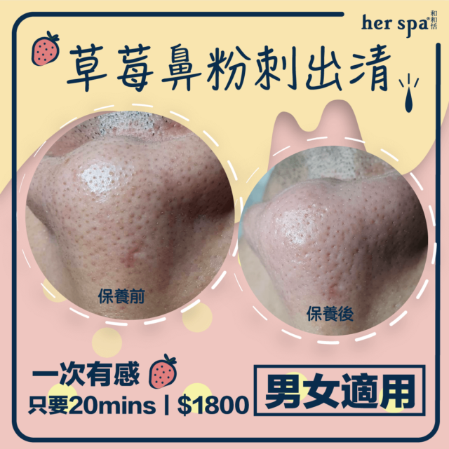 臉部保養 快速有效 皮脂髒污 如何洗臉 熱敷