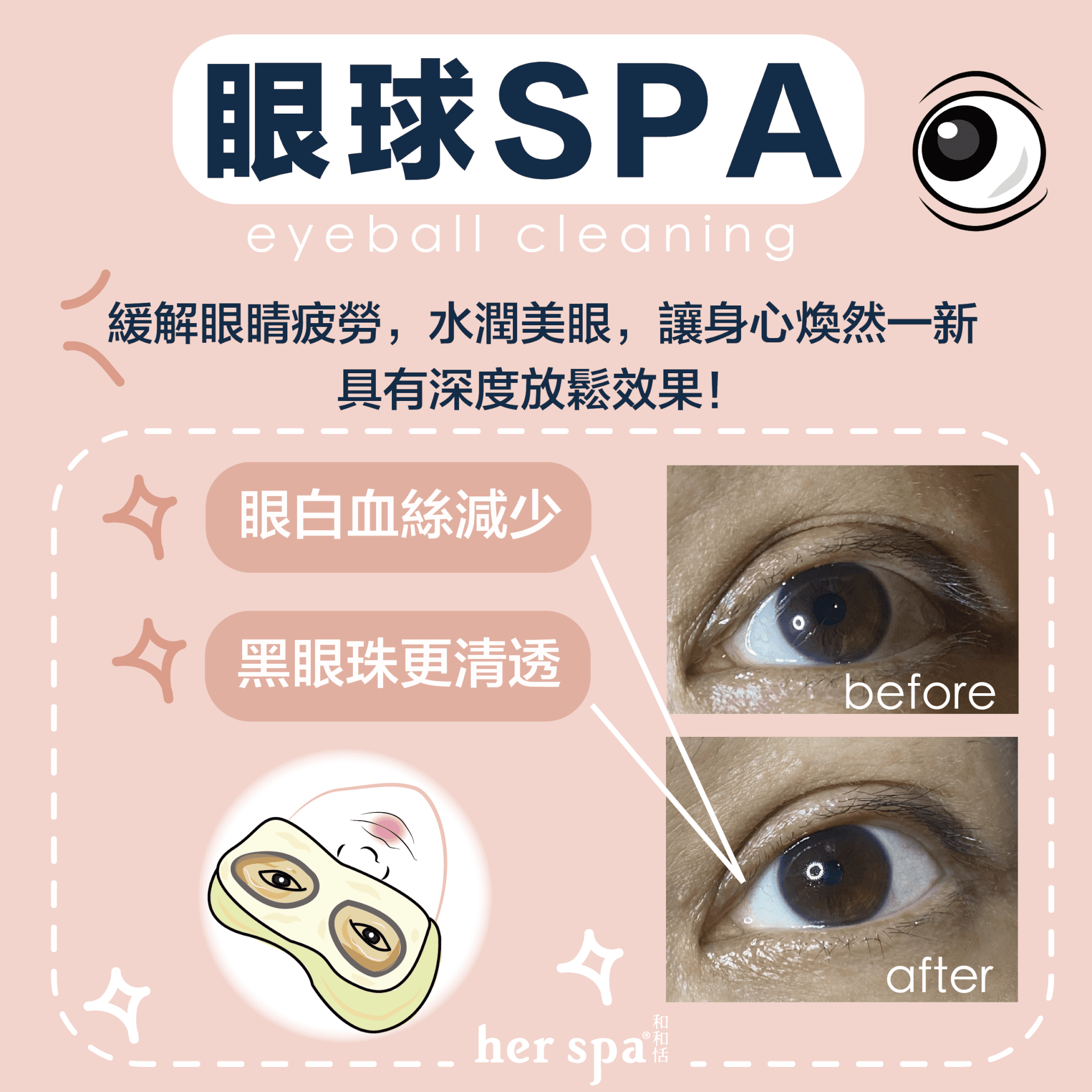 洗眼睛 眼睛保健食品 眼睛健康 眼睛保健 乾眼症Eyecleaning 蒸氣眼罩 電動蒸眼罩