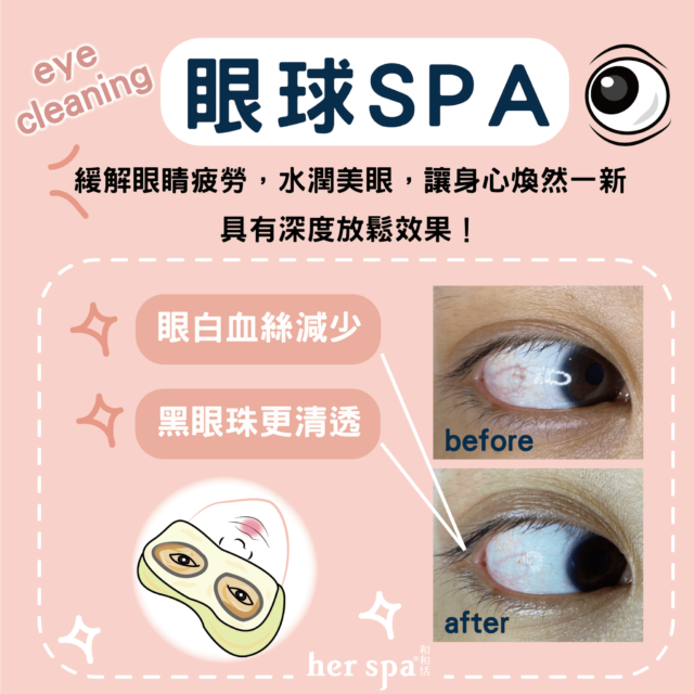 眼睛按摩推薦 洗眼睛推薦 用油洗眼睛 高雄洗眼睛 台北洗眼睛 眼球Spa Eyecleaning Eyeballspa Relieveeyestrain