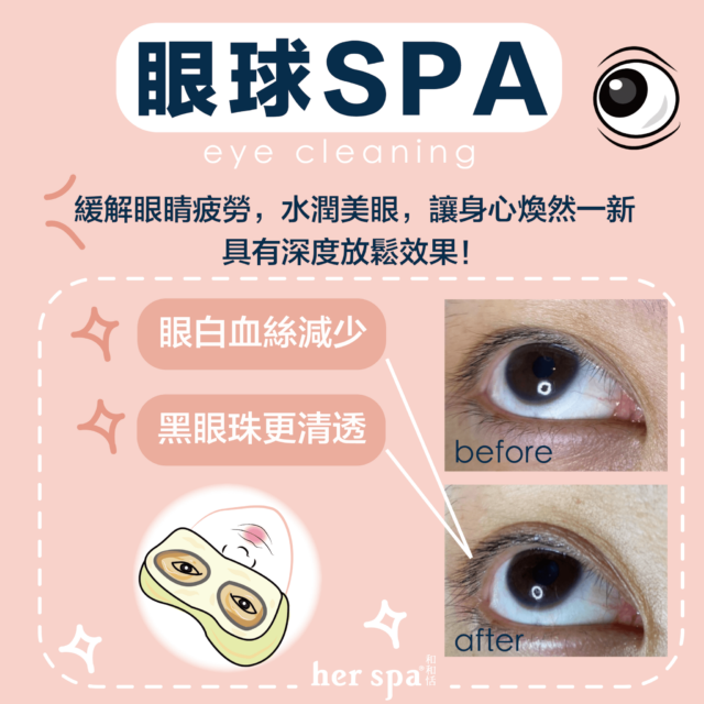 眼睛按摩推薦 洗眼睛推薦 用油洗眼睛 高雄洗眼睛 台北洗眼睛 眼球Spa Eyecleaning 蒸氣眼罩 電動眼睛按摩器