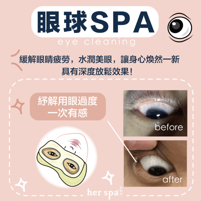 洗眼睛 眼睛保健食品 眼睛健康 眼睛保健 乾眼症 Eyecleaning 蒸氣眼罩 電動蒸眼罩 人工淚液 葉黃素有效嗎