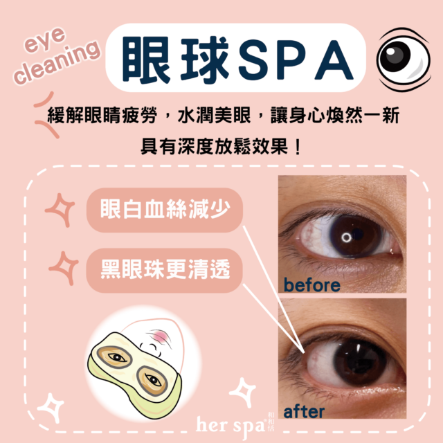 eyespa eyetherapy eyecleaning eyeballclean eyeballspa relieveeyestrain 護眼按摩 眼部紓壓 眼睛保健 眼部疲勞按摩