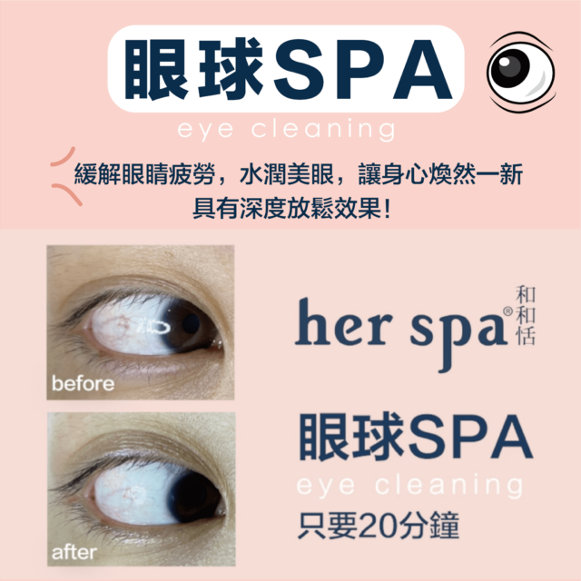 眼睛按摩推薦 洗眼睛推薦 用油洗眼睛 高雄洗眼睛 台北洗眼睛 眼球Spa Eyecleaning 蒸氣眼罩 電動眼睛按摩器