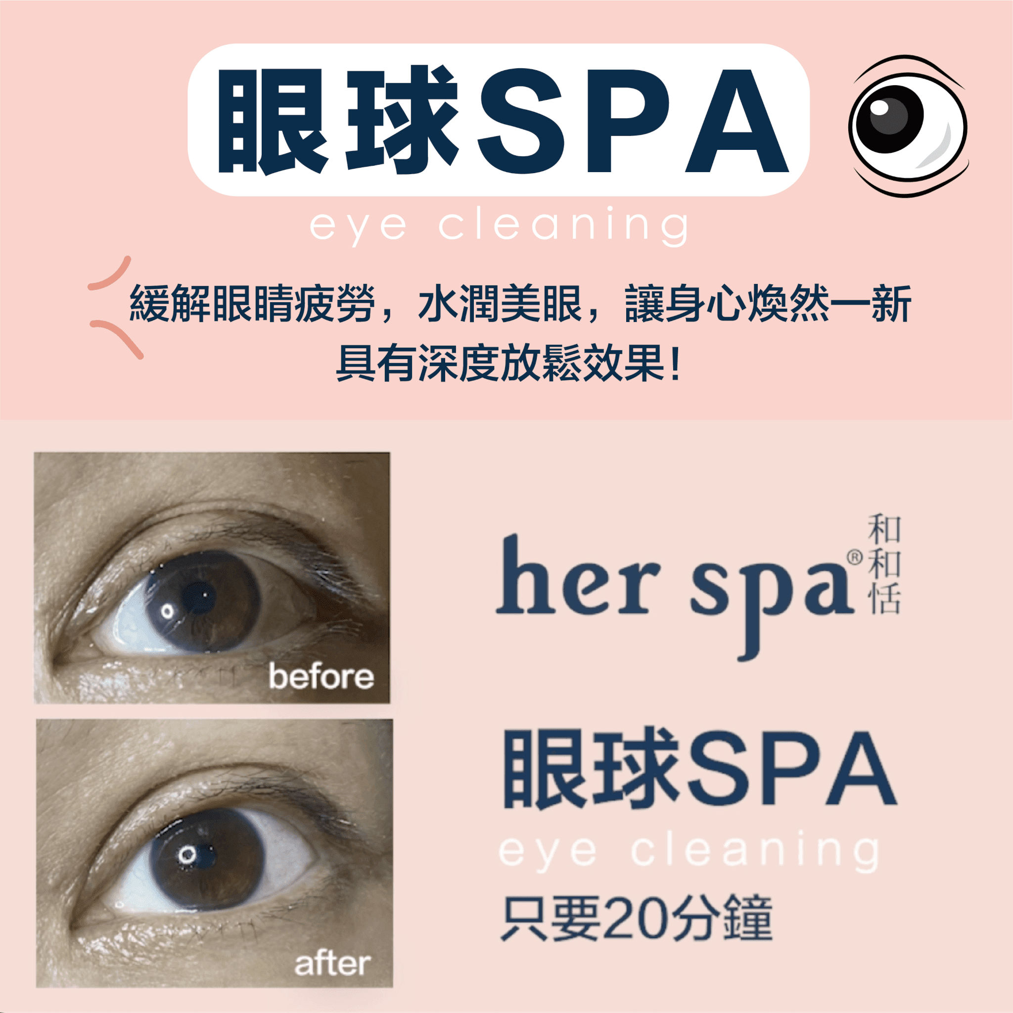 眼睛過勞讓您的眼睛恢復活力 告別雙眼無神 Her Spa 和和恬